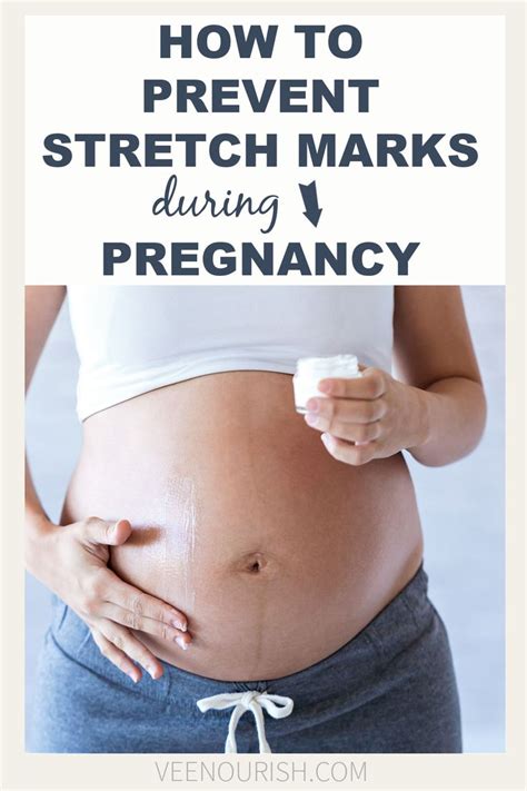Where do you get stretch marks during pregnancy